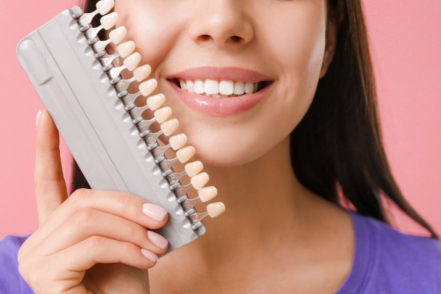 Everything You Need To Know About Veneers