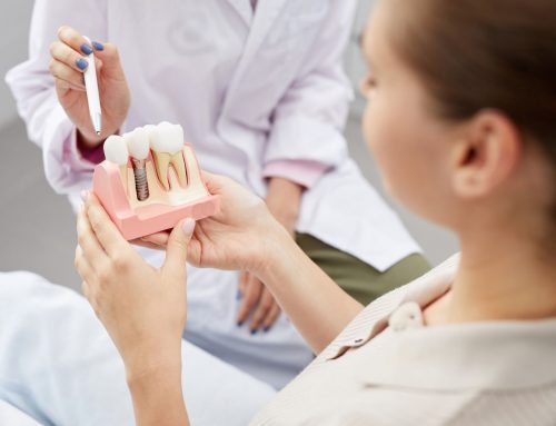 Dental Implants vs. Dentures: Which Is Right for You?