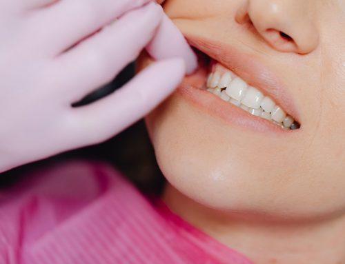 What Is Teeth Grinding (Bruxism) & How Does It Damage Your Smile?