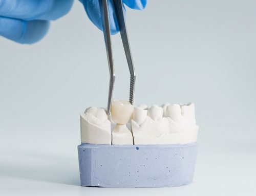 Dental Crowns: When You Need One & What the Process Looks Like