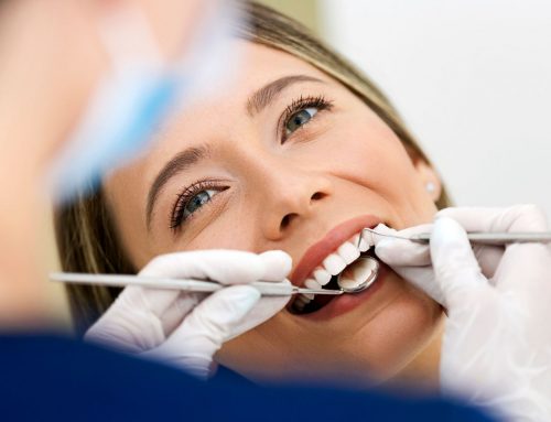 Scaling & Root Planing: What to Expect from a Deep Cleaning